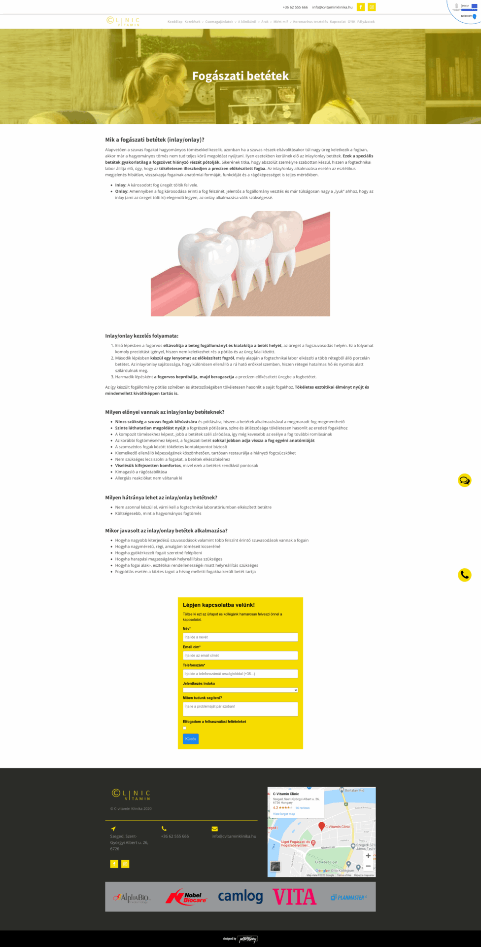 Fogászati-betétek-C-Vitamin-Klinika
