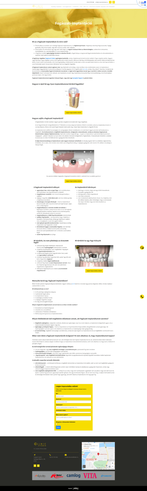 Fogászati-implantáció-C-Vitamin-Klinika