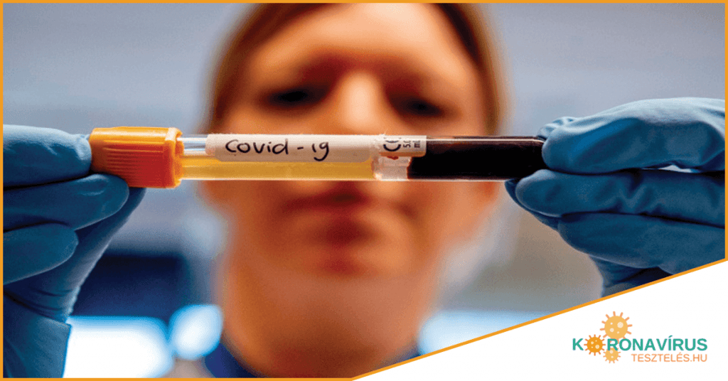 Social Media Post Mockup